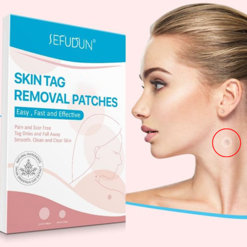 Skin Tag Removal Treatment Patch