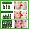 Acne Removal Acne Scar Cream Pore Size Reduction And Oil Control Herbal Acne Cream