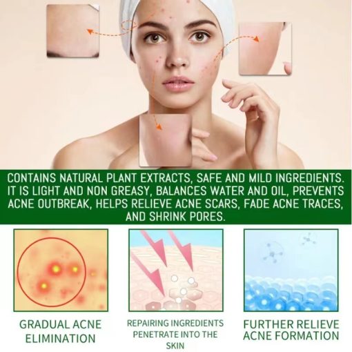 Acne Removal Acne Scar Cream Pore Size Reduction And Oil Control Herbal Acne Cream