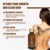 Elecool 30Ml Tattoo Removal Liquid 100% Safe Permanent Clean Tattoo Portable Natural Plant Extracts Body Art Paint Removal Cream