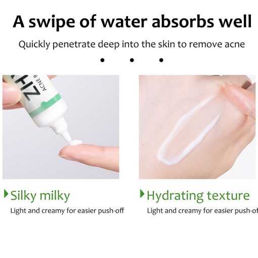 Salicylic Acid Acne Cream Remove Blackhead Oil Control Anti-Acne Treatment Repair Pimple Acne Scar Whitening Face Cream Skincare