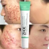 Salicylic Acid Acne Cream Remove Blackhead Oil Control Anti-Acne Treatment Repair Pimple Acne Scar Whitening Face Cream Skincare