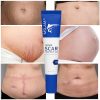 Scar Removal Cream Gel Remove Acne Spots Treatment Stretch Marks Burn Surgical Scar Repair Cream Smoothing Whitening Skin Beauty