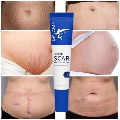 Scar Removal Cream Gel Remove Acne Spots Treatment Stretch Marks Burn Surgical Scar Repair Cream Smoothing Whitening Skin Beauty