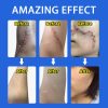 Scar Removal Cream Gel Treatment Stretch Marks Burn Remove Acne Spots Surgical Scar Repair Cream Acne Smoothing Skin Beauty