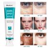 Whitening Freckle Cream Face Moisturizing Remove Dark Spots Melanin Melasma Remover Brightening Skin Effective Repair Anti-Aging