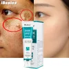 Whitening Freckle Cream Face Moisturizing Remove Dark Spots Melanin Melasma Remover Brightening Skin Effective Repair Anti-Aging