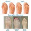 Bestwalk Orthopedic Sandals For Women20
