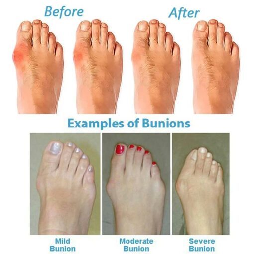 Bestwalk Orthopedic Sandals For Women20