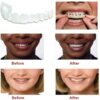 Teeth Veneer Silicone Top & Bottom